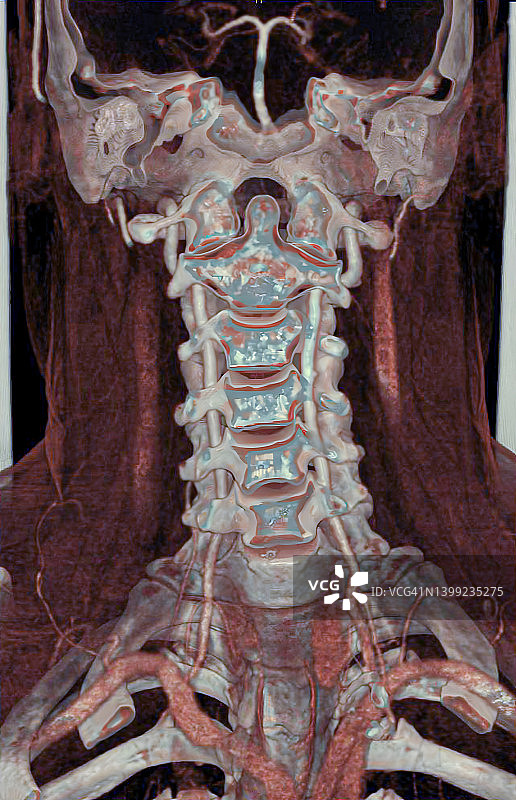 颈椎扫描图图片素材