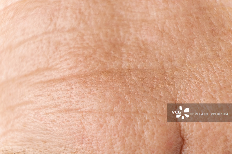 白人男子布满皱纹的额头图片素材