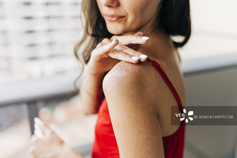 女人在晒伤的皮肤上涂抹润肤霜特写图片素材