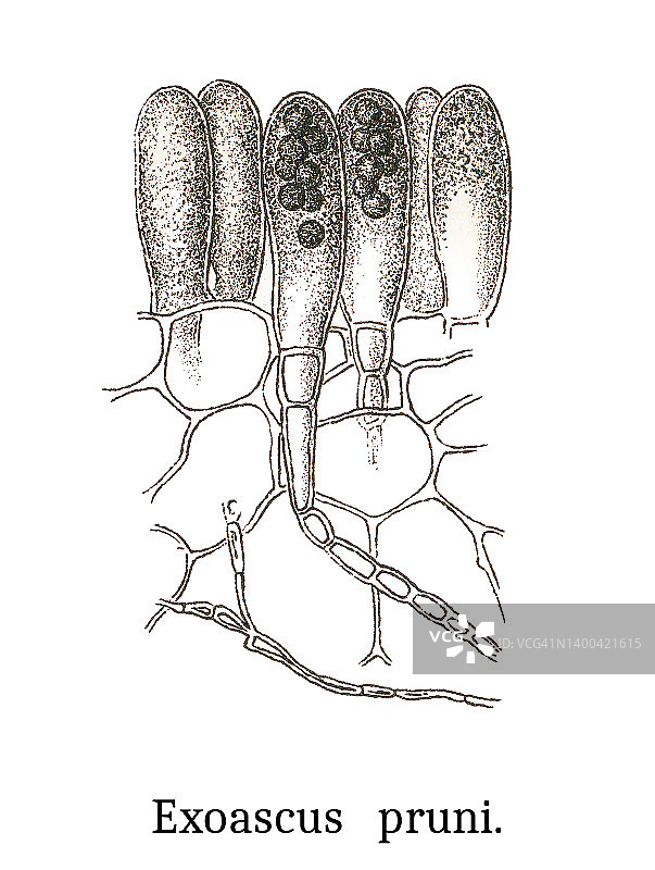 植物病害的古老雕刻插图：黑刺李的真菌植物病原体，引起袋果或膀胱李瘿图片素材