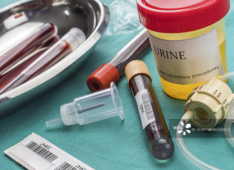 医院桌上的尿液和血液样本，概念图图片素材