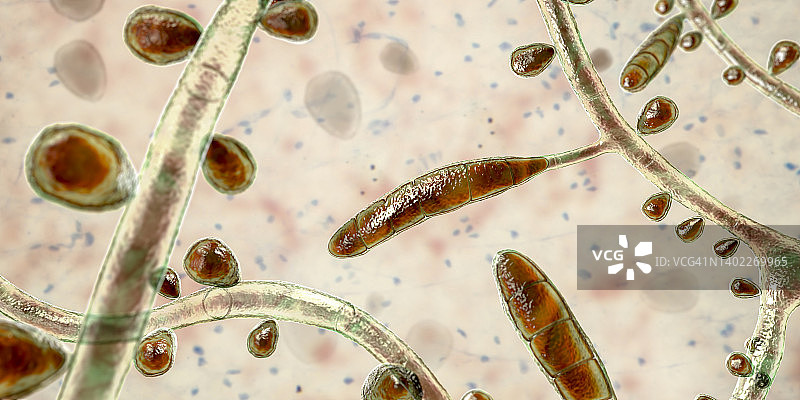 红色毛癣菌图片素材