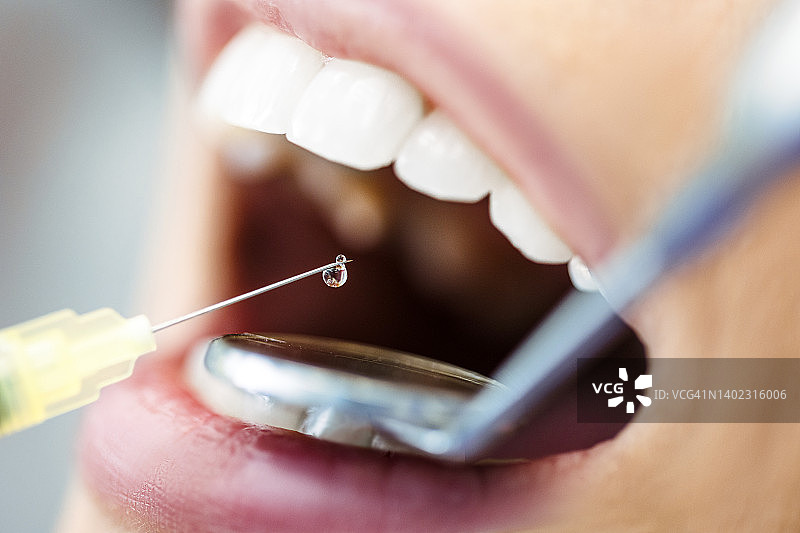 女人准备接受牙医麻醉图片素材