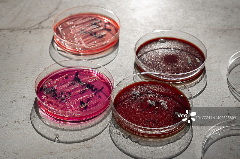 猴痘病毒：微生物实验室中用于细菌分析的微生物菌落培养皿图片素材