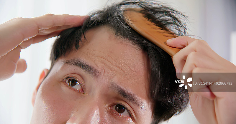 男人担心脱发图片素材