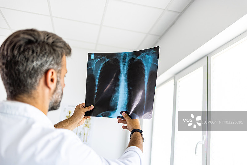 放射科医生在医院检查胸部X光片图片素材