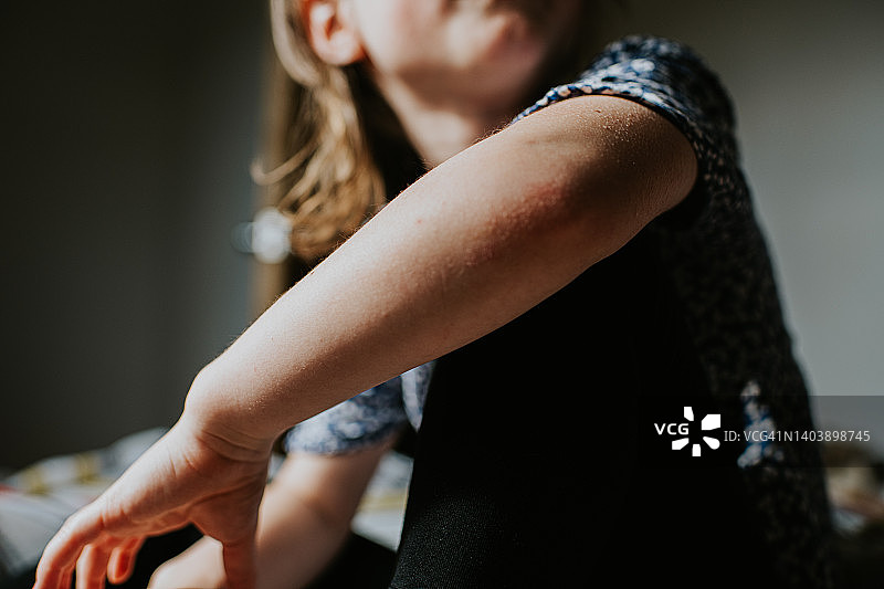 小女孩手臂的特写图片素材