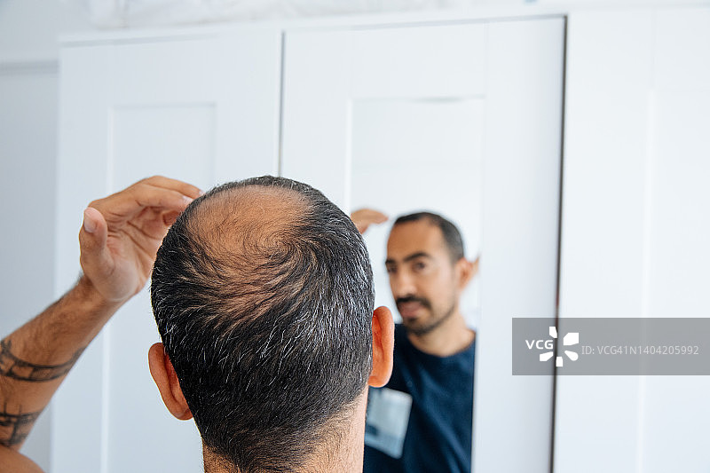 光头男人照镜子，看着头顶的秃发和脱发图片素材