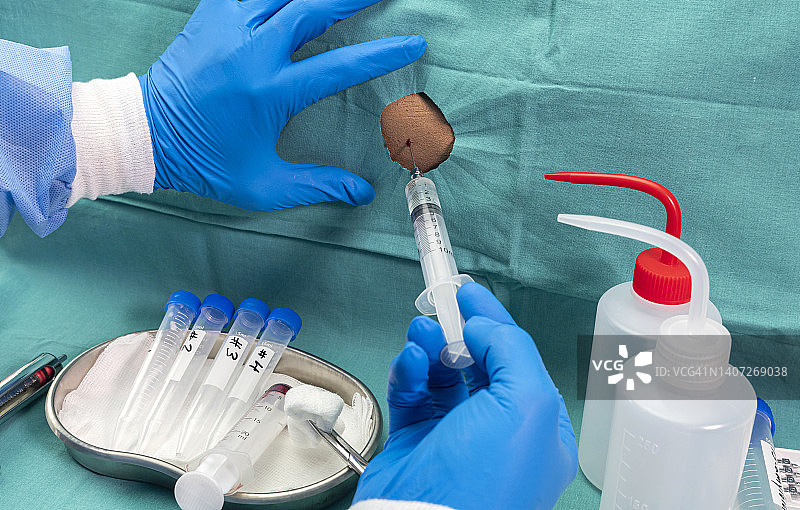 腰椎穿刺图片素材