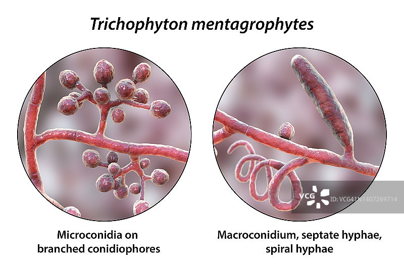 须癣毛癣菌真菌插图图片素材