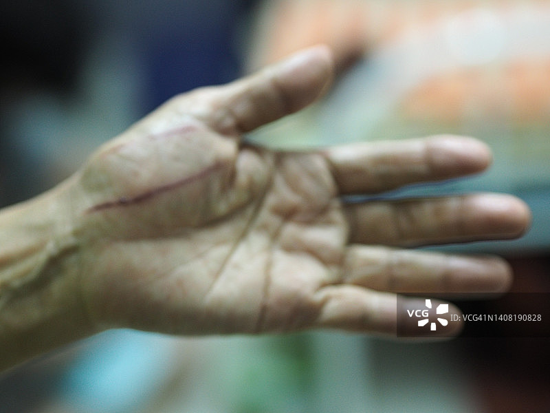 女人手掌上的伤口图片素材