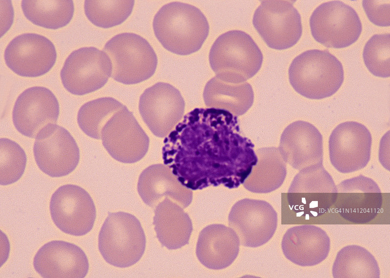 嗜碱性粒细胞——与炎症反应相关的粒状白细胞（粒细胞），400倍图片素材
