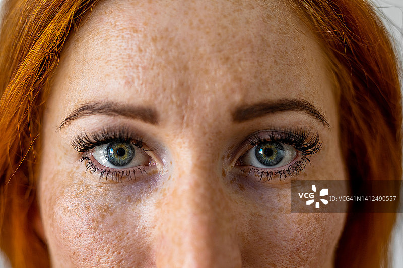 面部雀斑特写图片素材