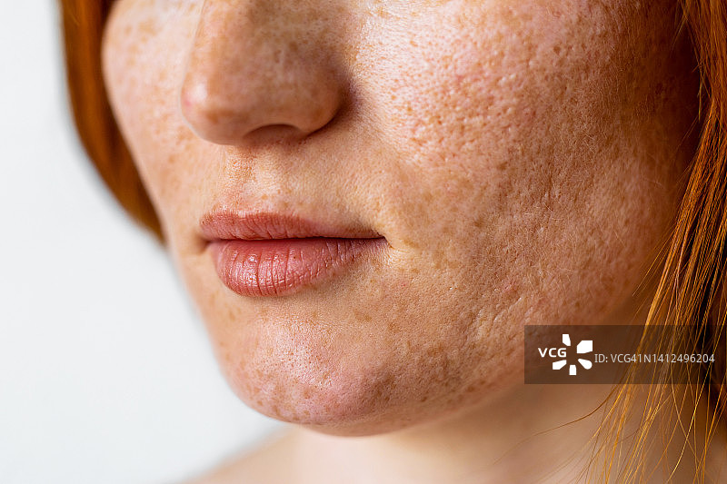 有雀斑的女性面部图片素材