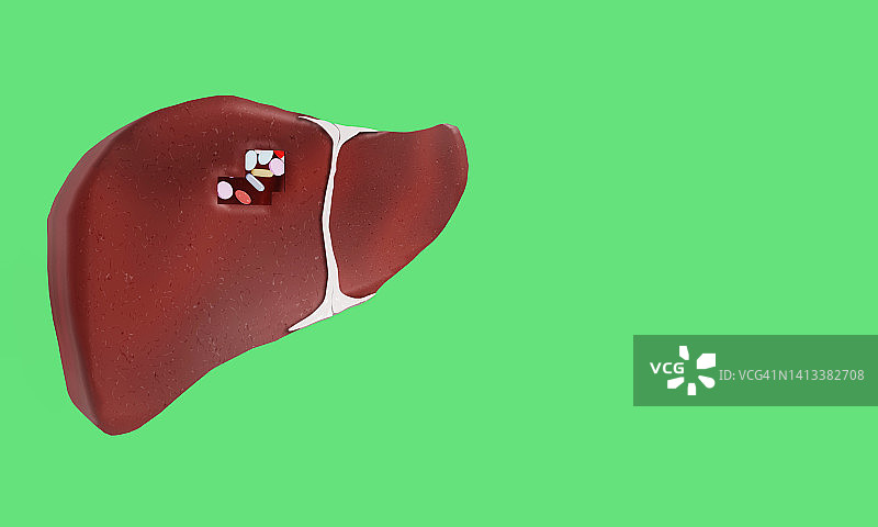 无人癌症概念图图片素材