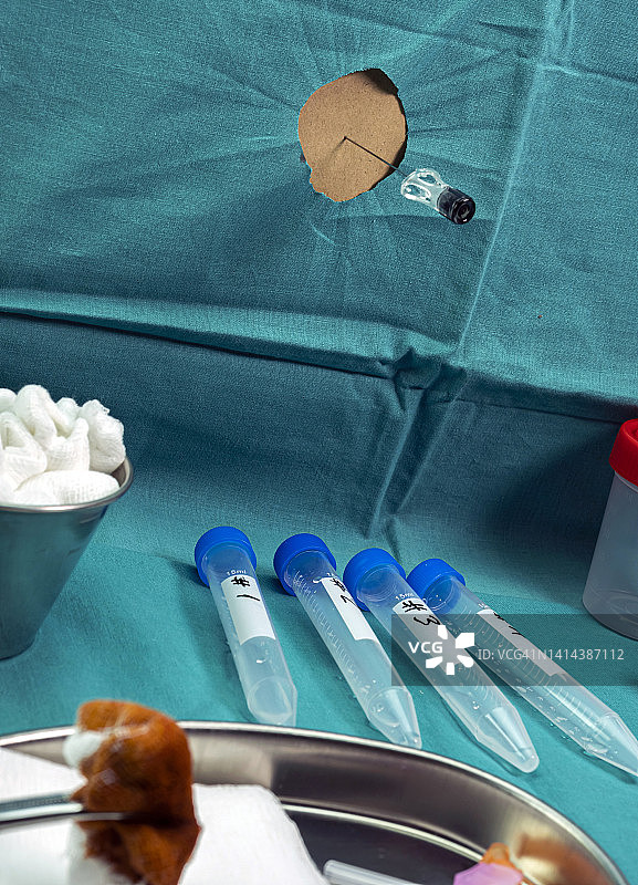 腰椎穿刺图片素材