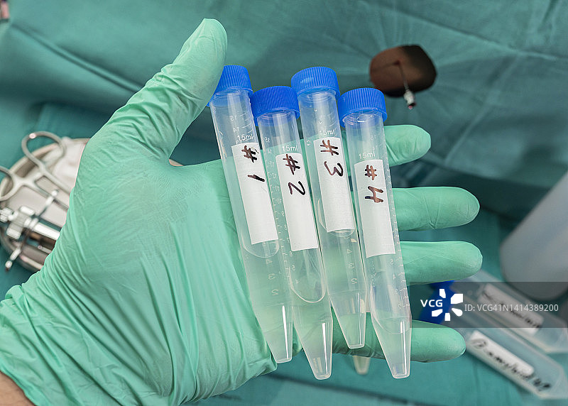 脑脊液样本试管图片素材
