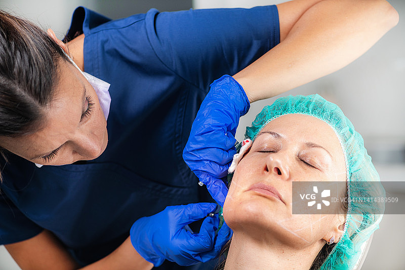 面部埋线提升术图片素材