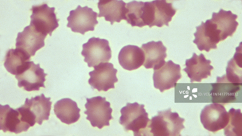 高渗盐溶液中的红细胞（5% NaCl），600倍图片素材
