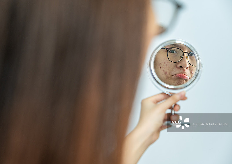 亚洲女性对着小镜子，担心自己脸上的痤疮问题图片素材
