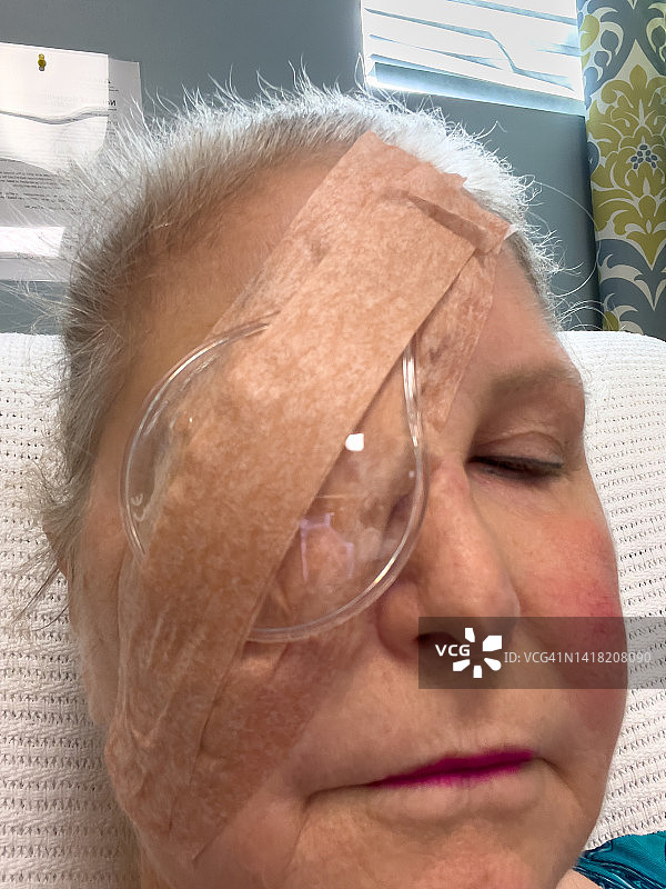 白内障手术后的女人图片素材