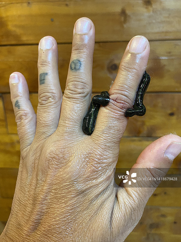 水蛭疗法图片素材