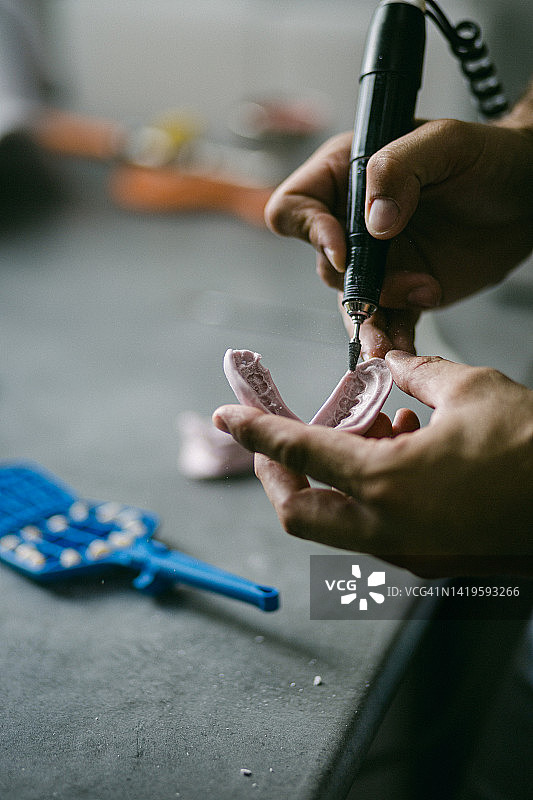 用于牙科修复体树脂粘合的机械固位图片素材