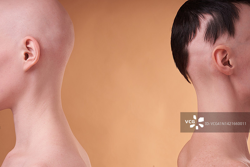 两名身份不明的女性背靠背，面临脱发问题，处于不同阶段。浅米色背景，留白图片素材