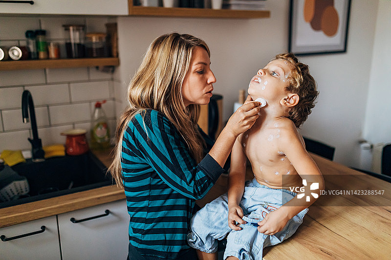 母亲给儿子脖子上涂抹治疗水痘的药图片素材