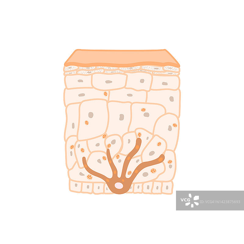 皮肤色素沉淀插图图片素材