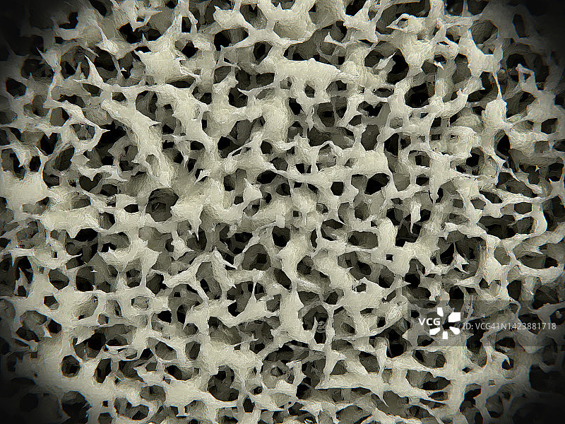 骨质疏松骨组织插图图片素材