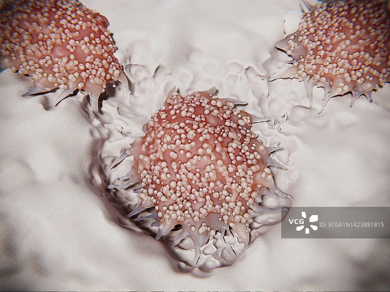 骨骼上的破骨细胞，图示图片素材