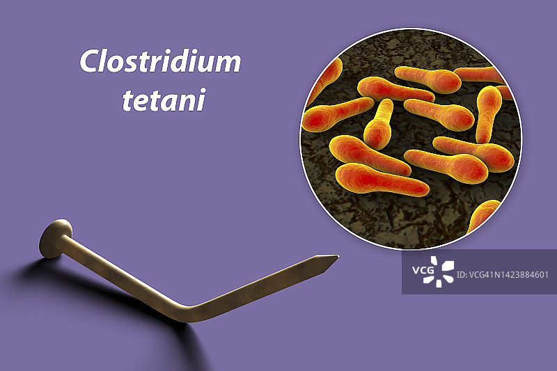 破伤风传播概念图图片素材