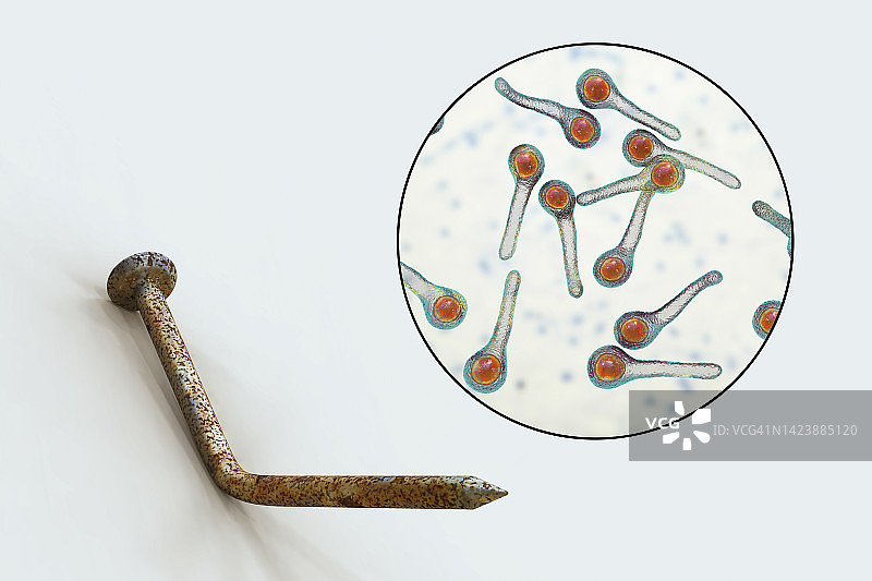 破伤风传播概念图图片素材