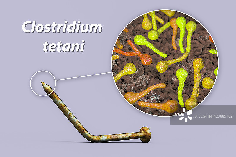 破伤风传播概念图图片素材