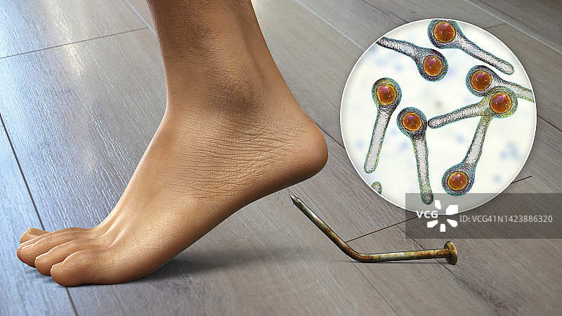 感染传播，图示图片素材