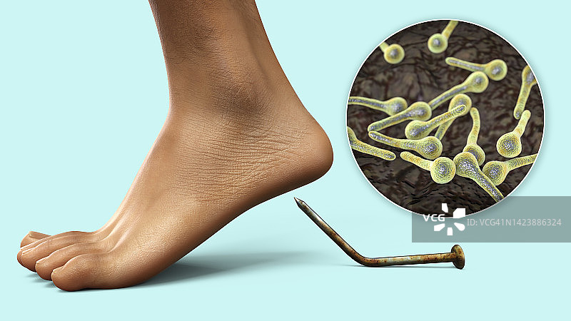 感染传播，图示图片素材