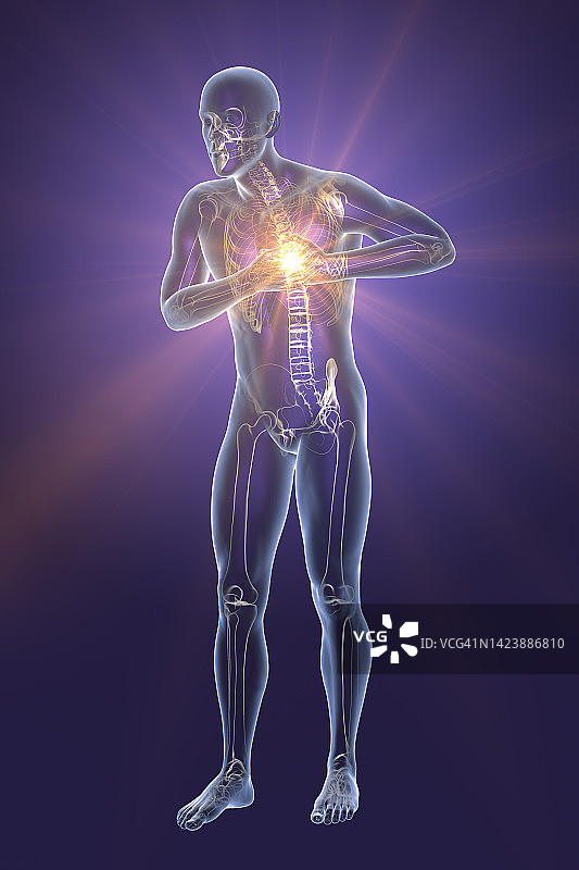 胸痛的男子插图图片素材