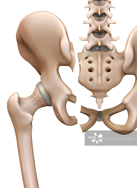 骨盆骨折图示图片素材