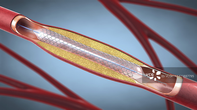 支架插图图片素材