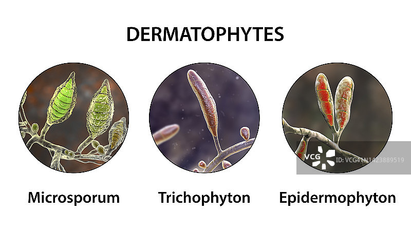 皮肤癣菌真菌，图示图片素材