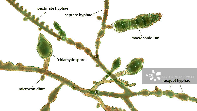 奥杜安小孢子菌插图图片素材