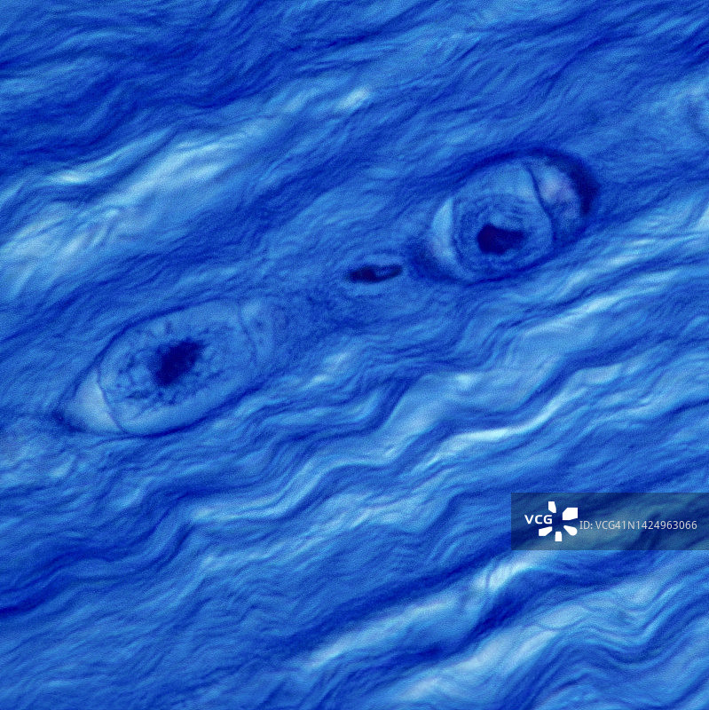 纤维软骨——软骨细胞、腔隙、胶原纤维，椎间盘，400倍图片素材