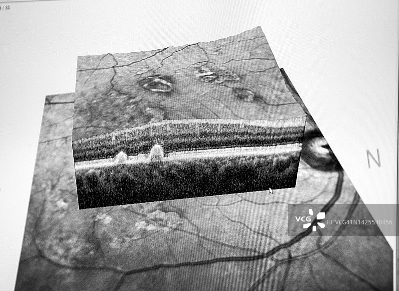 光学相干断层扫描图片素材