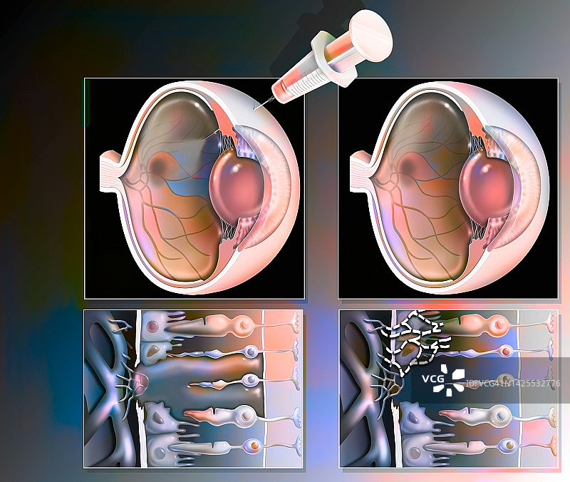 Dmla绘图处理图片素材