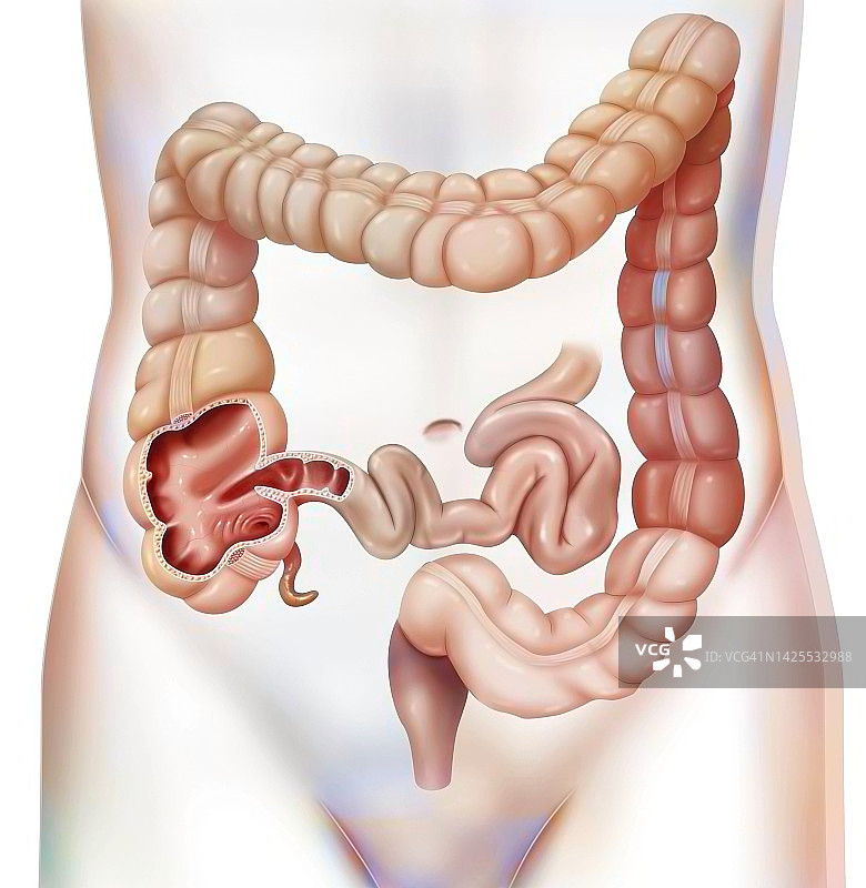 结肠绘画图片素材
