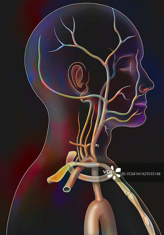 颈动脉图图片素材