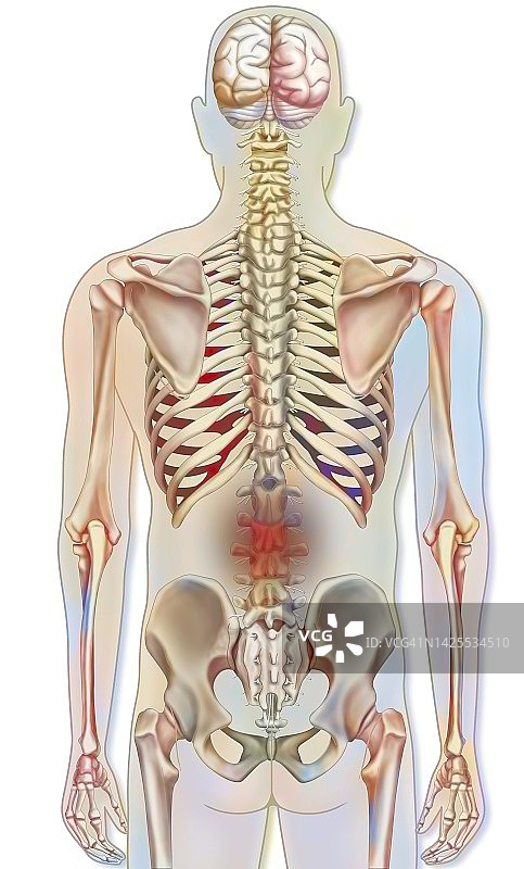 背痛示意图图片素材