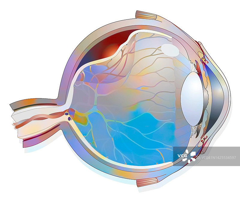视网膜脱离图图片素材