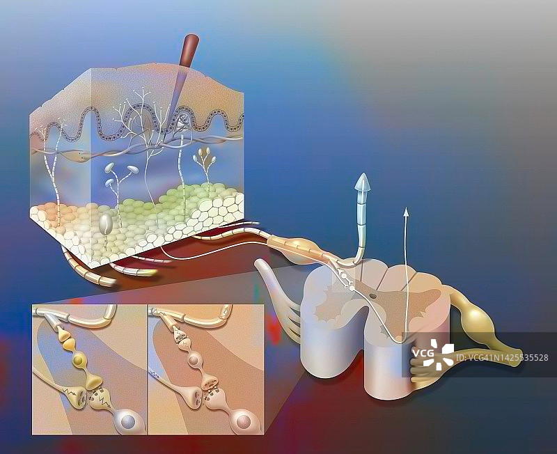 疼痛绘画图片素材